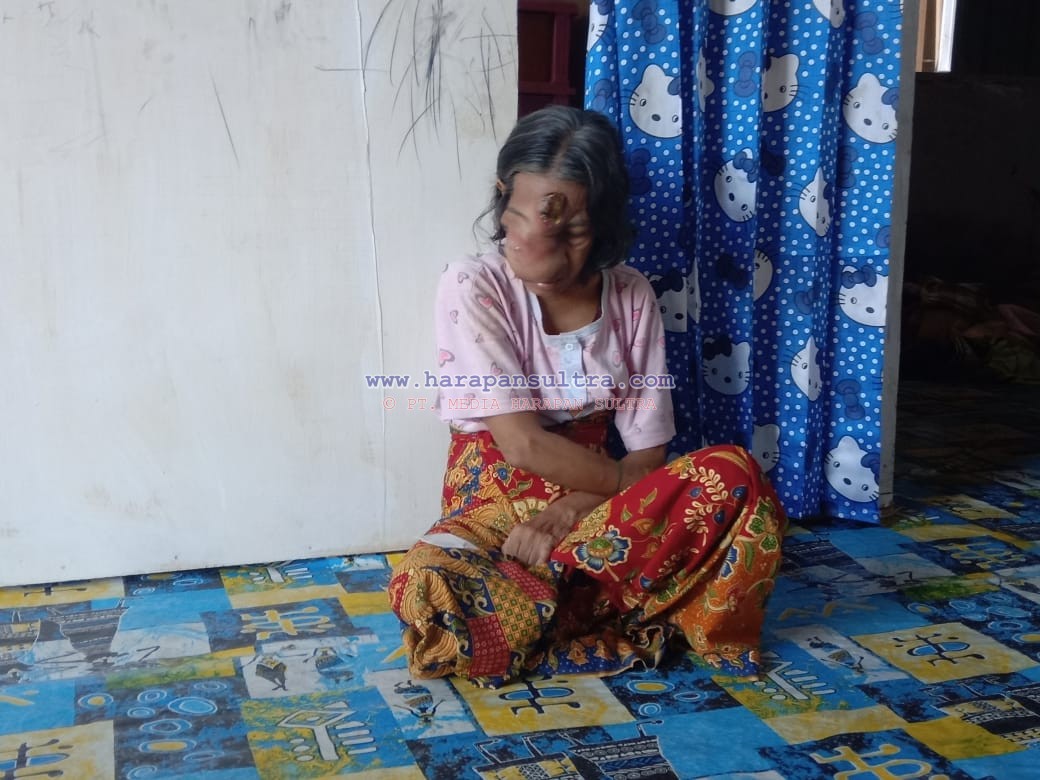 Bolong, Penderita Tumor Ganas di Bombana